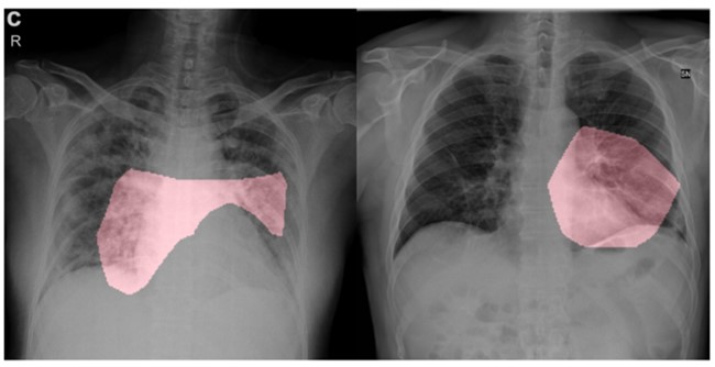 GenSynth-xray.jpg